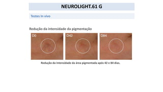 NEUROLIGHT.61 G
Testes In vivo
Redução da intensidade da pigmentação
Redução da intensidade da área pigmentada após 42 e 84 dias.
 