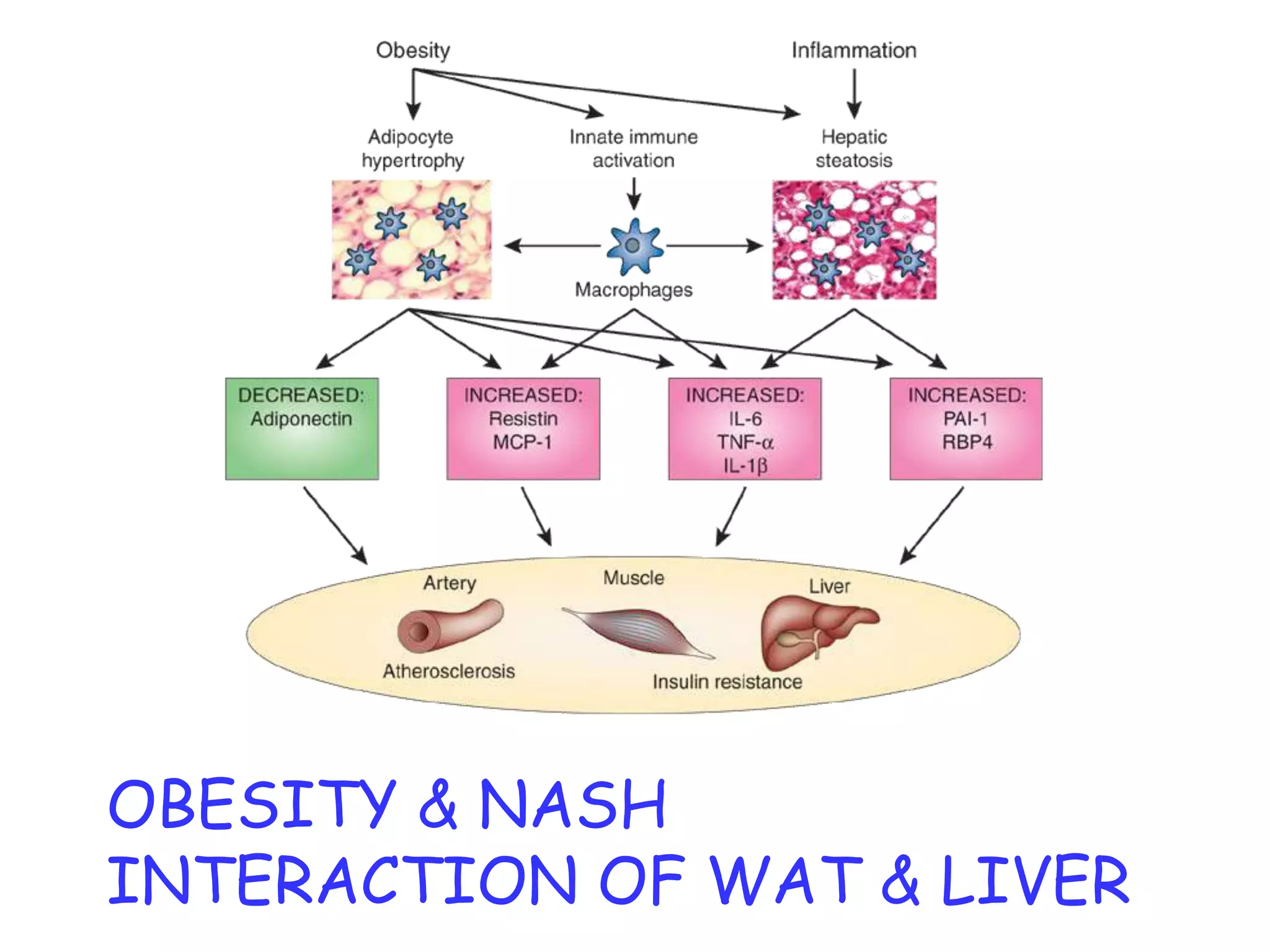 OBESITY & NASH
INTERACTION OF WAT & LIVER
 
