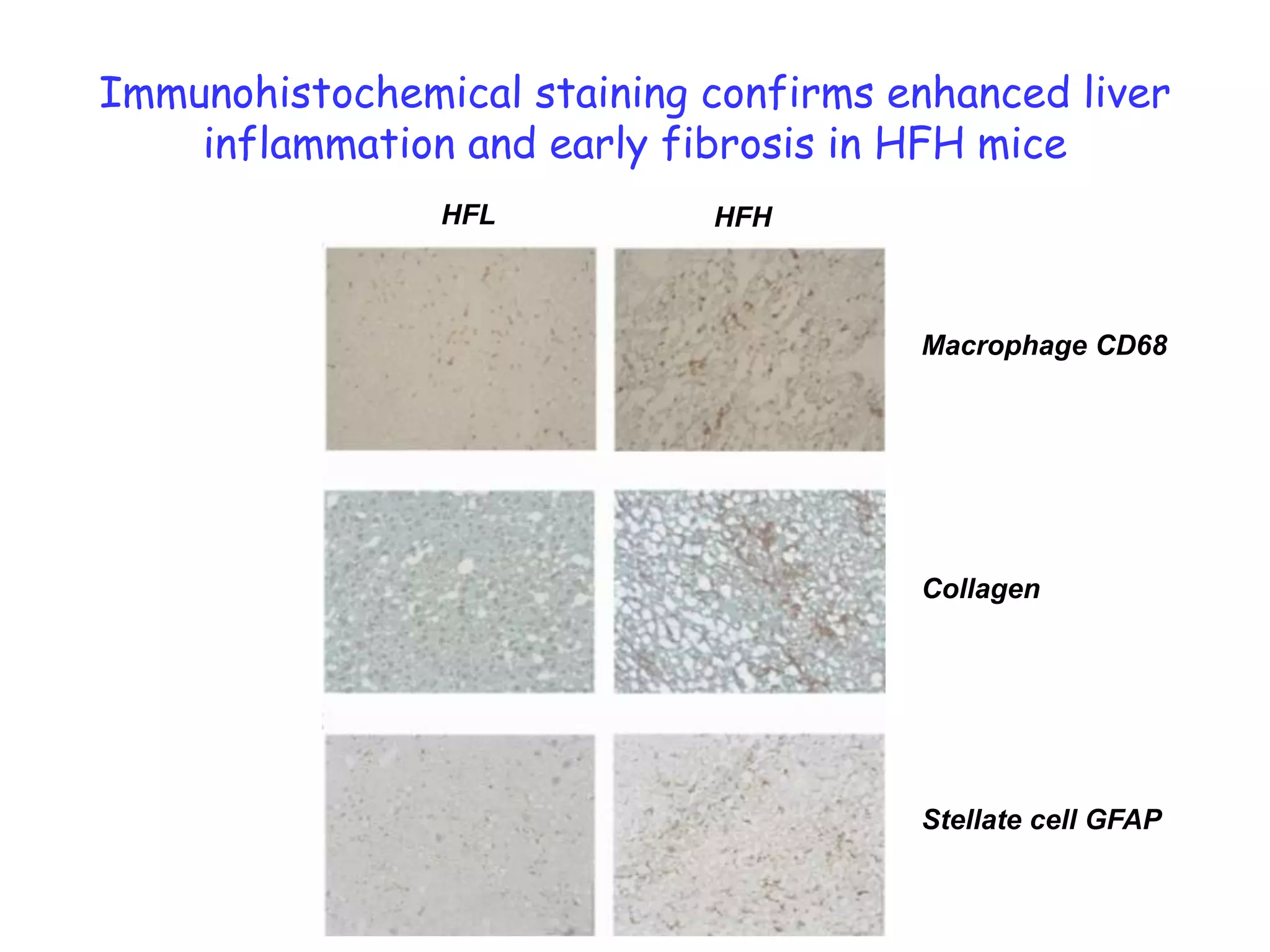 Immunohistochemical staining confirms enhanced liver
    inflammation and early fibrosis in HFH mice
                HFL          HFH



                                       Macrophage CD68




                                       Collagen




                                       Stellate cell GFAP
 