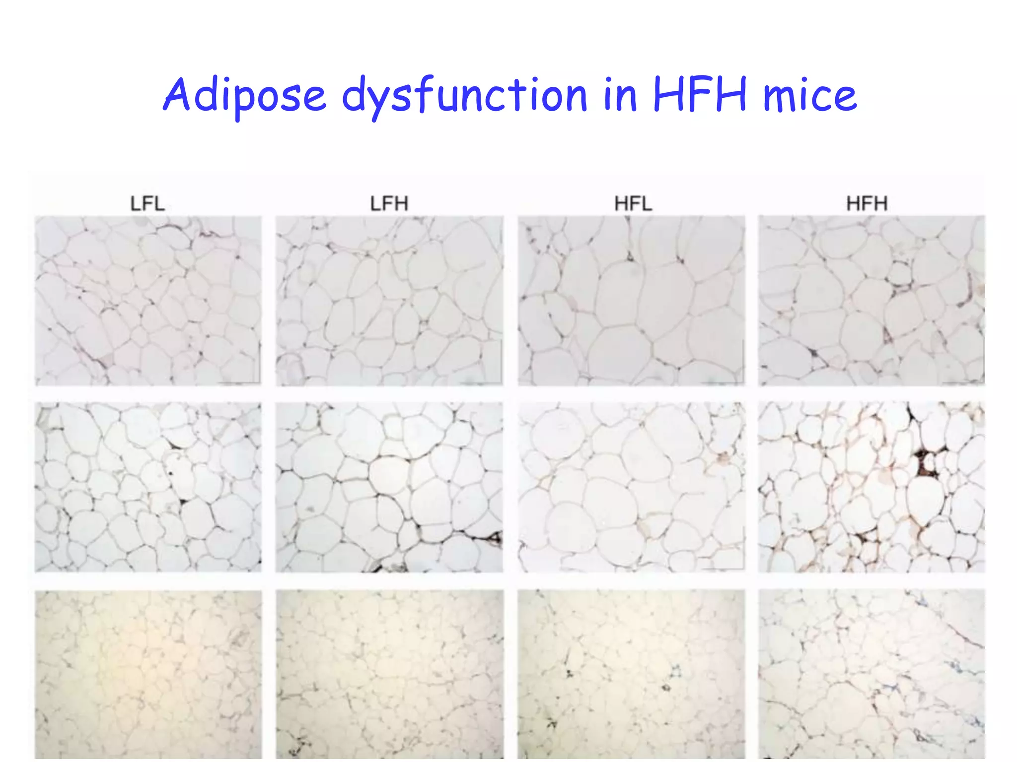 Adipose dysfunction in HFH mice
 