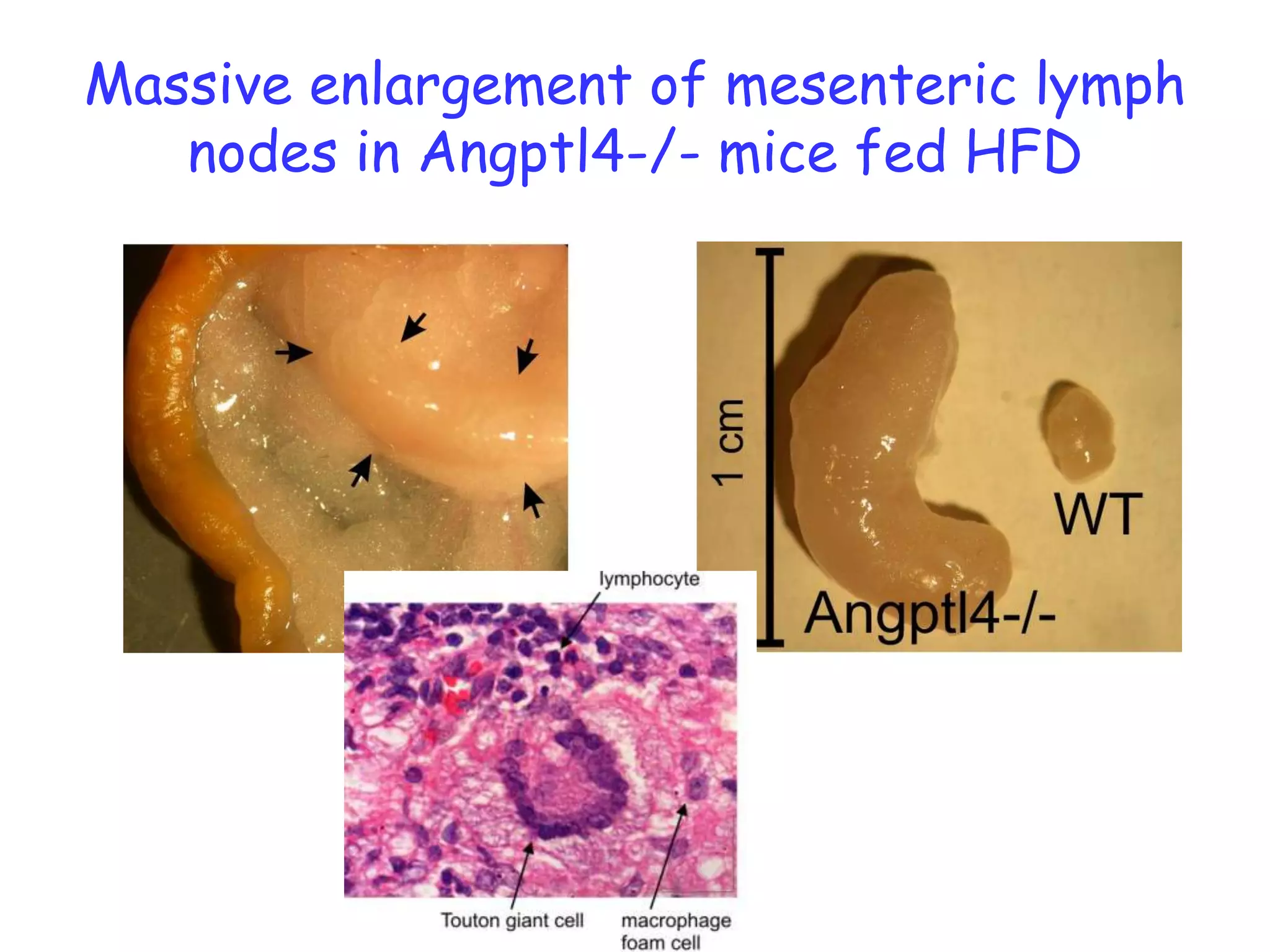 Massive enlargement of mesenteric lymph
   nodes in Angptl4-/- mice fed HFD
 