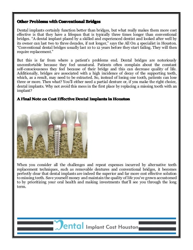 Cost Effective of Dental Implants in Houston What You Get For Your M…