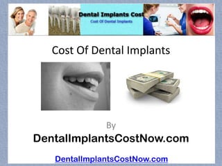 Cost Of Dental Implants




              By
DentalImplantsCostNow.com
   DentalImplantsCostNow.com
 