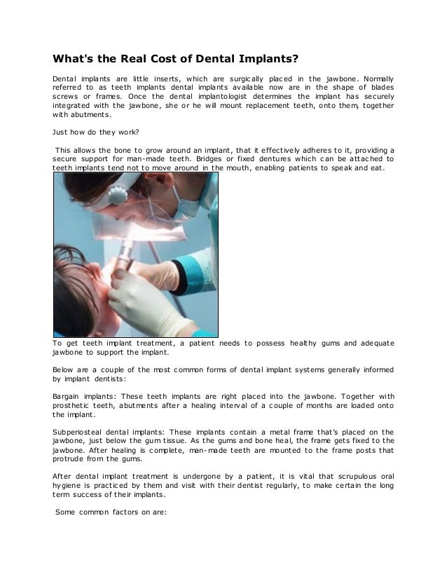 Cost of dental implants in toronto