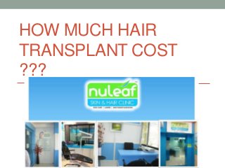 HOW MUCH HAIR
TRANSPLANT COST
???
 