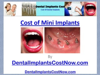 Cost of Mini Implants



               By
DentalImplantsCostNow.com
    DentalImplantsCostNow.com
 