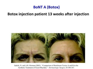 Costridial toxins botulinum toxin | PPT