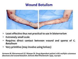 Costridial toxins botulinum toxin
