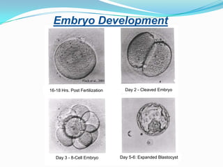 Individualizing Ovarian Stimulation Protocols for IVF | PPTX