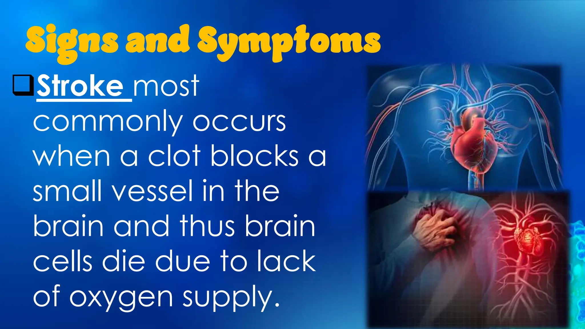 Signs and Symptoms
Stroke most
commonly occurs
when a clot blocks a
small vessel in the
brain and thus brain
cells die due to lack
of oxygen supply.
 