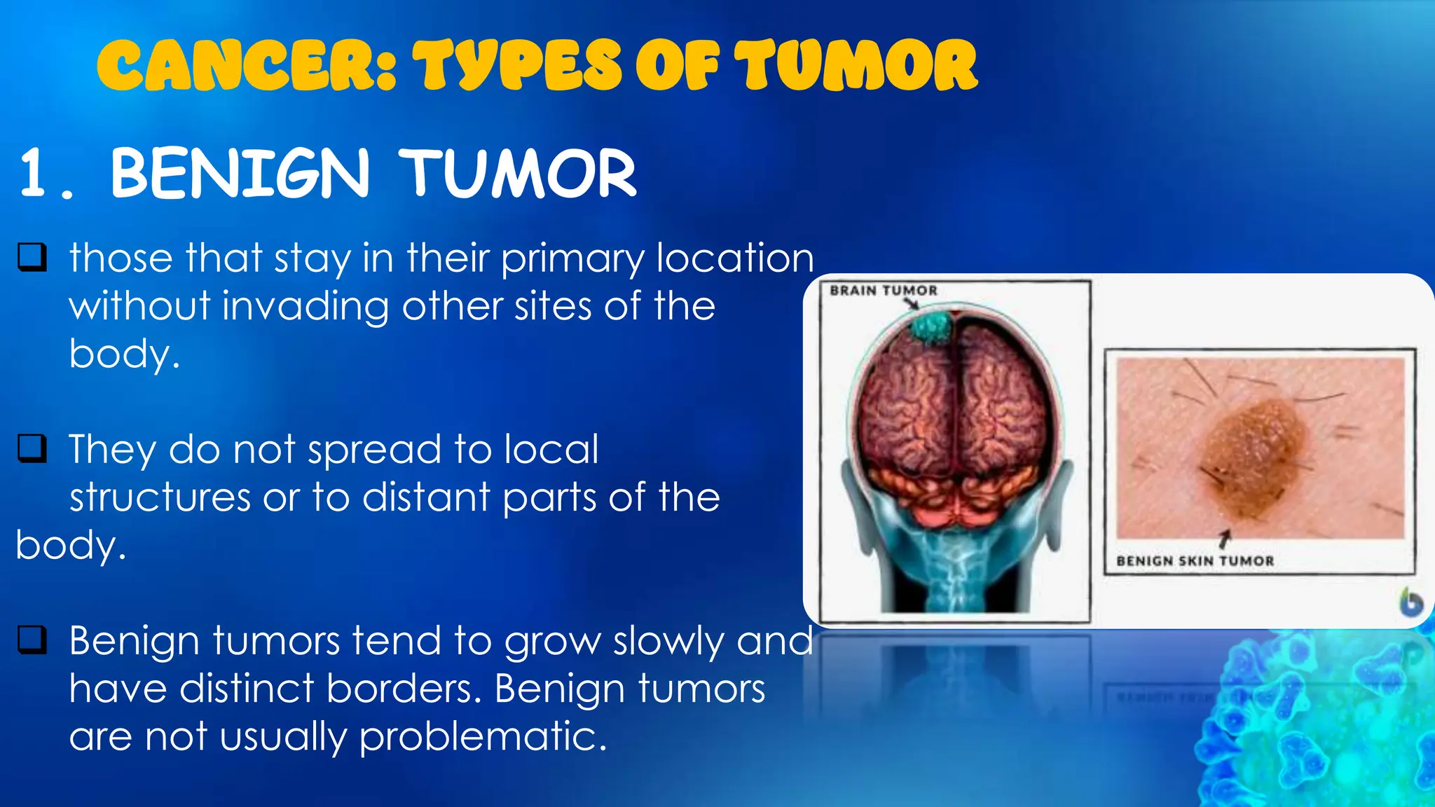 1. BENIGN TUMOR
CANCER: TYPES OF TUMOR
 those that stay in their primary location
without invading other sites of the
body.
 They do not spread to local
structures or to distant parts of the
body.
 Benign tumors tend to grow slowly and
have distinct borders. Benign tumors
are not usually problematic.
 