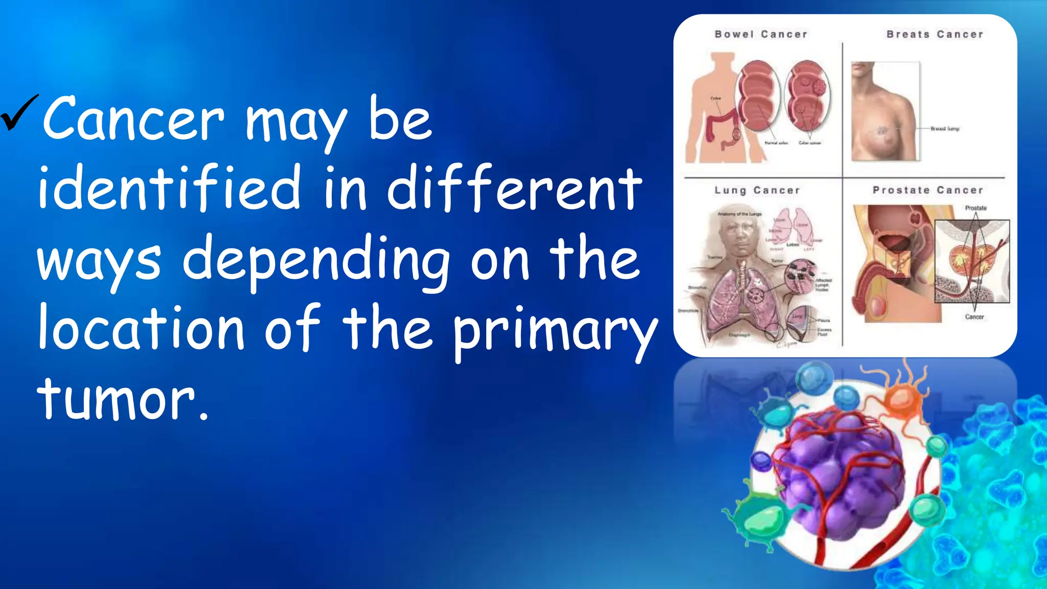 Cancer may be
identified in different
ways depending on the
location of the primary
tumor.
 