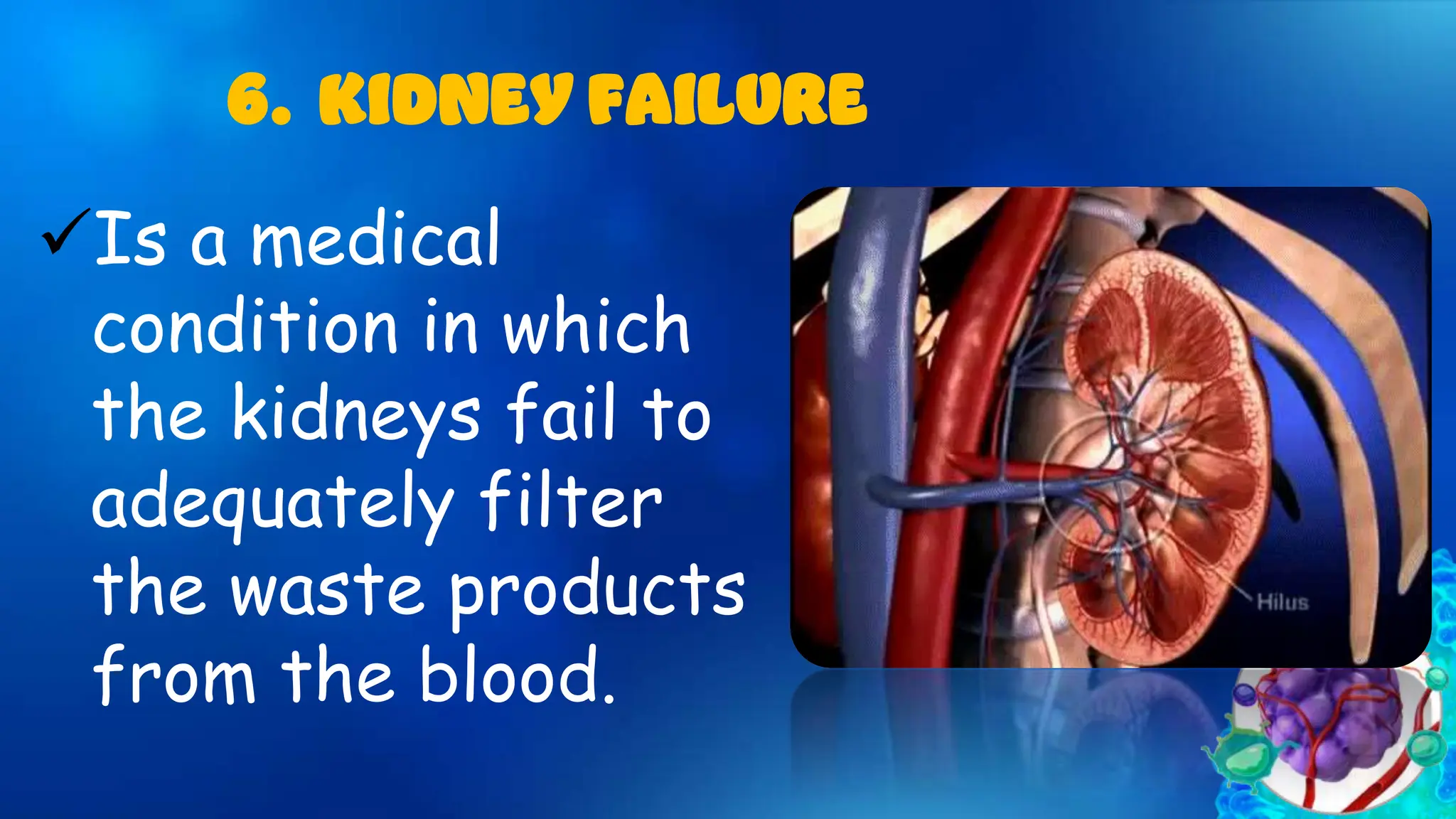 Is a medical
condition in which
the kidneys fail to
adequately filter
the waste products
from the blood.
6. KIDNEY FAILURE
 