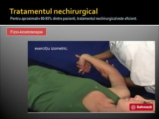 Fizio-kinetoterapie
exerci iu izometric.ț
 