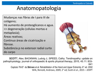 Anatomopatologia
Mudanças nas fibras de I para III de
colágeno;
Há aumento de proteoglicanos e agua.
=> degeneração (células mortas e
metaplasia);
Áreas reativas;
Continuo áreas de cicatrização e
fibrose.
Substância p no extensor radial curto
do carpo
Tendinopatia no Cotovelo
SCOTT, Alex; BACKMAN, Ludvig J.; SPEED, Cathy. Tendinopathy: update on
pathophysiology. journal of orthopaedic & sports physical therapy, 2015, 45.11: 833-
841
Capitulo 78-87 de Skirven et al. Rehabilitation of the Hand and Upper Extremity. 6° ed. 2002
Wilk, Reinold, Andrews, 2009, 2° ed; Scott et al., 2015 – JOSPT
 