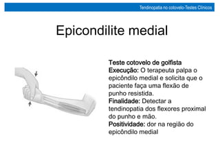 Teste cotovelo de golfista
Execução: O terapeuta palpa o
epicôndilo medial e solicita que o
paciente faça uma flexão de
punho resistida.
Finalidade: Detectar a
tendinopatia dos flexores proximal
do punho e mão.
Positividade: dor na região do
epicôndilo medial
Epicondilite medial
Tendinopatia no cotovelo-Testes Clínicos
 