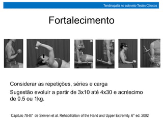 Considerar as repetições, séries e carga
Sugestão evoluir a partir de 3x10 até 4x30 e acréscimo
de 0.5 ou 1kg.
Fortalecimento
Capitulo 78-87 de Skirven et al. Rehabilitation of the Hand and Upper Extremity. 6° ed. 2002
Tendinopatia no cotovelo-Testes Clínicos
 