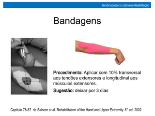 Procedimento: Aplicar com 10% transversal
aos tendões extensores e longitudinal aos
músculos extensores.
Sugestão: deixar por 3 dias
Capitulo 78-87 de Skirven et al. Rehabilitation of the Hand and Upper Extremity. 6° ed. 2002
Bandagens
Tendinopatia no cotovelo-Reabilitação
 