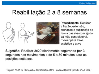 Procedimento: Realizar
a flexão, extensão,
pronação e supinação de
forma passiva com ajuda
da mão contralateral.
Evoluir para ativo
assistido e ativo
Sugestão: Realizar 3x20 diariamente segurando por 3
segundos nos movimentos e de 5 a 30 minutos para as
posições estáticas
Reabilitação 2 a 8 semanas
Capitulo 78-87 de Skirven et al. Rehabilitation of the Hand and Upper Extremity. 6° ed. 2002
Fratura de Cotovelo
 