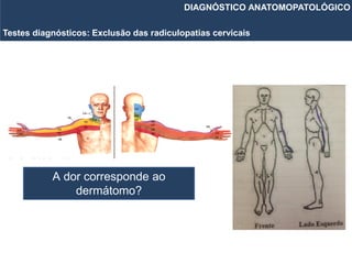 Testes diagnósticos: Exclusão das radiculopatias cervicais
DIAGNÓSTICO ANATOMOPATOLÓGICO
A dor corresponde ao
dermátomo?
 