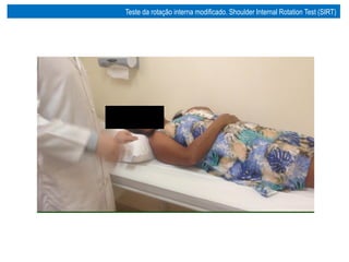 Teste da rotação interna modificado. Shoulder Internal Rotation Test (SIRT)
 