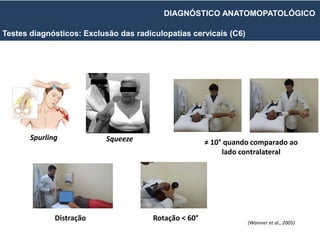 Spurling
Rotação < 60°
≠ 10° quando comparado ao
lado contralateral
Distração
Squeeze
(Wainner et al., 2005)
Testes diagnósticos: Exclusão das radiculopatias cervicais (C6)
DIAGNÓSTICO ANATOMOPATOLÓGICO
 