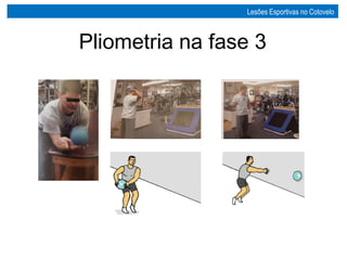 Pliometria na fase 3
Lesões Esportivas no Cotovelo
 