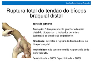 Teste do gancho
Execução: O terapeuta tenta ganchar o tendão
distal do bíceps com o indicador durante a
supinação do antebraço do paciente.
Finalidade: detectar a ruptura do tendão distal do
bíceps braquial.
Positividade: não sente o tendão na ponta do dedo
do terapeuta.
Sensibilidade = 100% Especificidade = 100%
Ruptura total do tendão do bíceps
braquial distal
Lesões Esportivas no Cotovelo
 