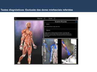 Testes diagnósticos: Exclusão das dores miofasciais referidas
 