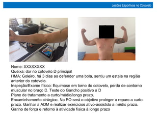 Nome: XXXXXXXX
Queixa: dor no cotovelo D principal
HMA: Goleiro, há 3 dias ao defender uma bola, sentiu um estala na região
anterior do cotovelo.
Inspeção/Exame físico: Equimose em torno do cotovelo, perda de contorno
muscular no braço D. Teste do Gancho positivo a D
Plano de tratamento a curto/médio/longo prazo.
Encaminhamento cirúrgico. No PO será o objetivo proteger o reparo a curto
prazo. Ganhar a ADM e realizar exercícios ativo-assistido a médio prazo.
Ganho de força e retorno à atividade física à longo prazo
Lesões Esportivas no Cotovelo
 