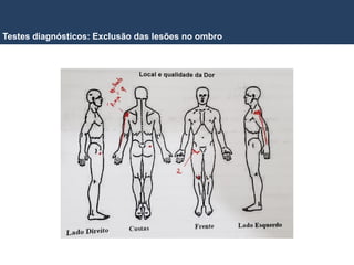 Testes diagnósticos: Exclusão das lesões no ombro
 
