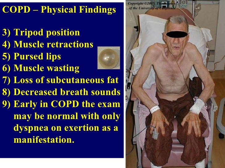 Cough In The Elderly