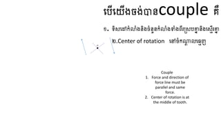 ធ្បើធ្យើងចង់បានcouple គឺ
១. ទិសធ្ៅកំលំងនិងចំនួនកំលំងទាំងពីរត្សបគ្នា និងធ្សេើរគ្នា
២.​
Center of rotation ធ្ៅចំកណ្ត
ត លធ្មេញ
CR
Couple
1. Force and direction of
force line must be
parallel and same
force.
2. Center of rotation is at
the middle of tooth.
 