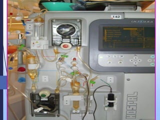 DEROULEMENT D’UNE
SEANCE DE DIALYSE
 