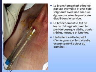  Le branchement est effectué
par une infirmière et une aide-
soignante avec une asepsie
rigoureuse selon le protocole
établi dans le service.
 Le branchement se fait de
façon chirurgicale avec le
port de casaque stérile, gants
stériles, masque et lunettes.
 L’infirmière vérifie le point
d’émergence et fera ensuite
un pansement autour du
cathéter.
 