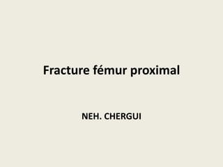 Fracture fémur proximal
NEH. CHERGUI
 