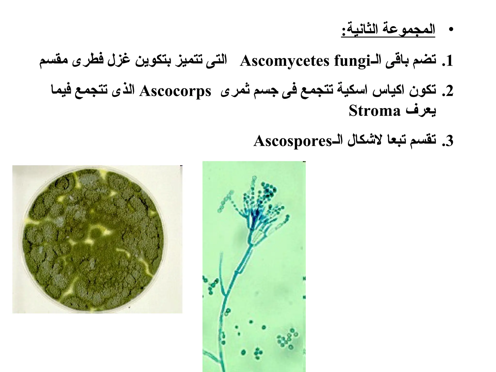 •
:‫الثانية‬ ‫المجموعة‬
.1
‫الـ‬ ‫باقى‬ ‫تضم‬
Ascomycetes fungi
‫مقسم‬ ‫فطرى‬ ‫غزل‬ ‫بتكوين‬ ‫تتميز‬ ‫التى‬
.2
‫ثمرى‬ ‫جسم‬ ‫فى‬ ‫تتجمع‬ ‫اسكية‬ ‫اكياس‬ ‫تكون‬
Ascocorps
‫فيما‬ ‫تتجمع‬ ‫الذى‬
‫يعرف‬
Stroma
.3
‫الـ‬ ‫الشكال‬ ‫تبعا‬ ‫تقسم‬
Ascospores
 