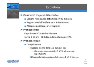 Occlusions vasculaires retiniennes