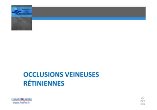 Occlusions vasculaires retiniennes
