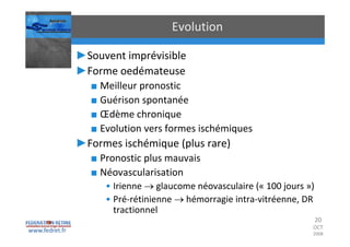 Occlusions vasculaires retiniennes