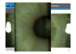Occlusions vasculaires retiniennes