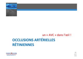 Occlusions vasculaires retiniennes