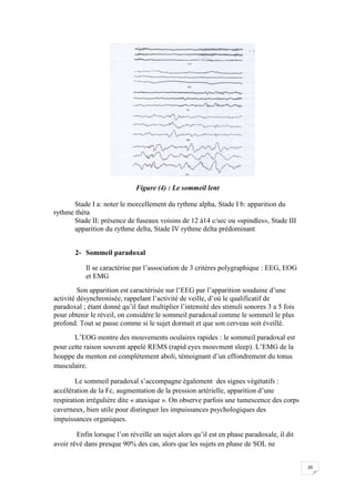 Figure (4) : Le sommeil lent

       Stade I a: noter le morcellement du rythme alpha, Stade I b: apparition du
rythme théta
       Stade II: présence de fuseaux voisins de 12 à14 c/sec ou «spindles», Stade III
       apparition du rythme delta, Stade IV rythme delta prédominant


       2- Sommeil paradoxal

           Il se caractérise par l’association de 3 critères polygraphique : EEG, EOG
           et EMG
         Son apparition est caractérisée sur l’EEG par l’apparition soudaine d’une
activité désynchronisée, rappelant l’activité de veille, d’où le qualificatif de
paradoxal ; étant donné qu’il faut multiplier l’intensité des stimuli sonores 3 a 5 fois
pour obtenir le réveil, on considère le sommeil paradoxal comme le sommeil le plus
profond. Tout se passe comme si le sujet dormait et que son cerveau soit éveillé.
       L’EOG montre des mouvements oculaires rapides : le sommeil paradoxal est
pour cette raison souvent appelé REMS (rapid eyes mouvment sleep). L’EMG de la
houppe du menton est complètement aboli, témoignant d’un effondrement du tonus
musculaire.

        Le sommeil paradoxal s’accompagne également des signes végétatifs :
accélération de la Fc, augmentation de la pression artérielle, apparition d’une
respiration irrégulière dite « ataxique ». On observe parfois une tumescence des corps
caverneux, bien utile pour distinguer les impuissances psychologiques des
impuissances organiques.

        Enfin lorsque l’on réveille un sujet alors qu’il est en phase paradoxale, il dit
avoir rêvé dans presque 90% des cas, alors que les sujets en phase de SOL ne


                                                                                           20
 
