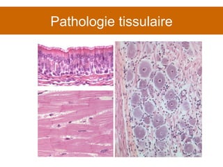 Pathologie tissulaire 