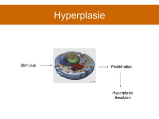 Hyperplasie Prolifération Hyperplasie tissulaire Stimulus 