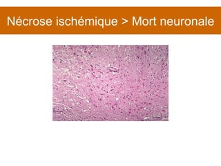 Nécrose ischémique > Mort neuronale 