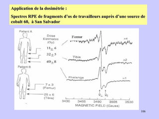 Application de la dosimétrie : Spectres RPE de fragments d’os de travailleurs auprès d’une source de cobalt 60,  à San Salvador   