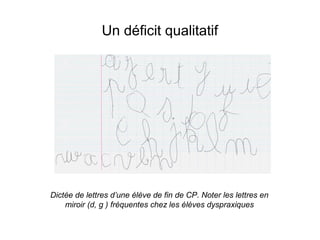 Un déficit qualitatif




Dictée de lettres d’une élève de fin de CP. Noter les lettres en
    miroir (d, g ) fréquentes chez les élèves dyspraxiques
 
