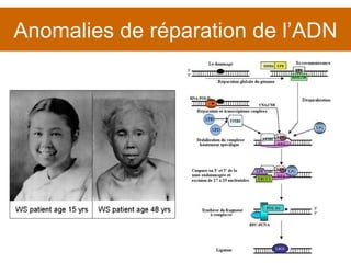 Anomalies de réparation de l’ADN 