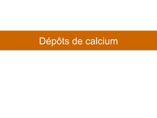 Dépôts de calcium 